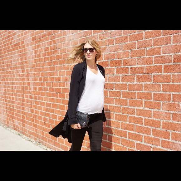 ✨HP!✨NWT Maternity-Friendly A.L.C. Trench Coat - Picture 2 of 8